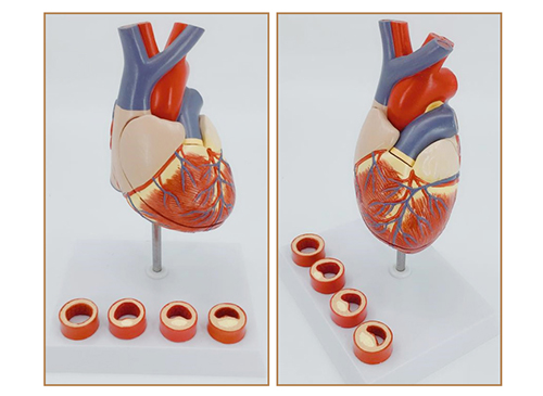心脏带血栓模型
